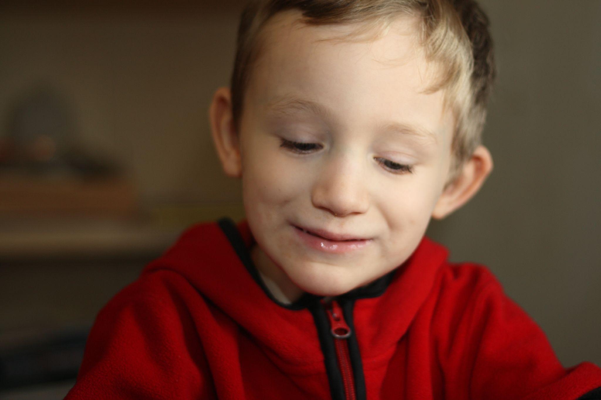 Developmental Disorders Feature Image