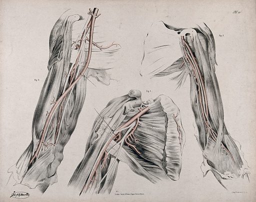 Blood Transfusion Feature Image