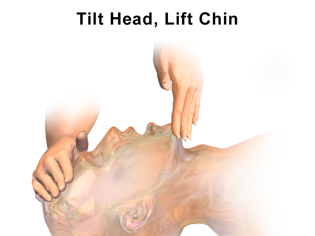Basic Approach to an Unwell Person Feature Image